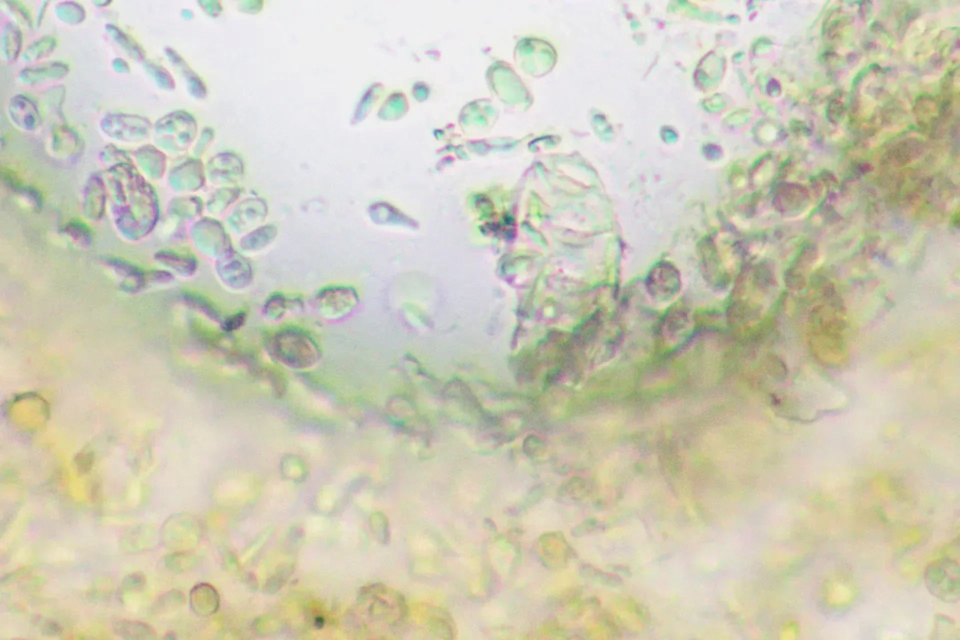 プロバイオティクス食品って何にいいの？