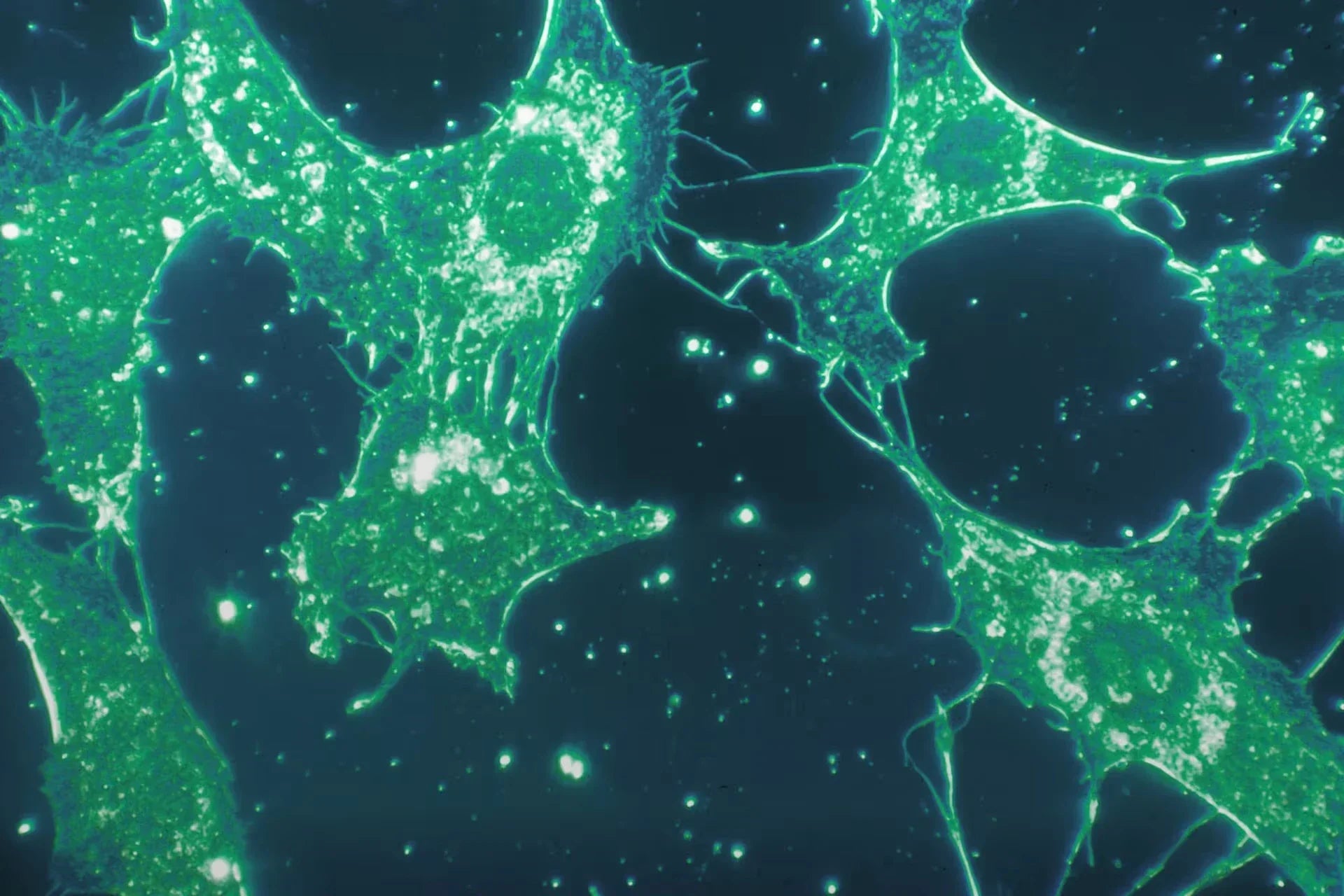 自然にできる！しなやかで強い「結合組織」を育てる方法